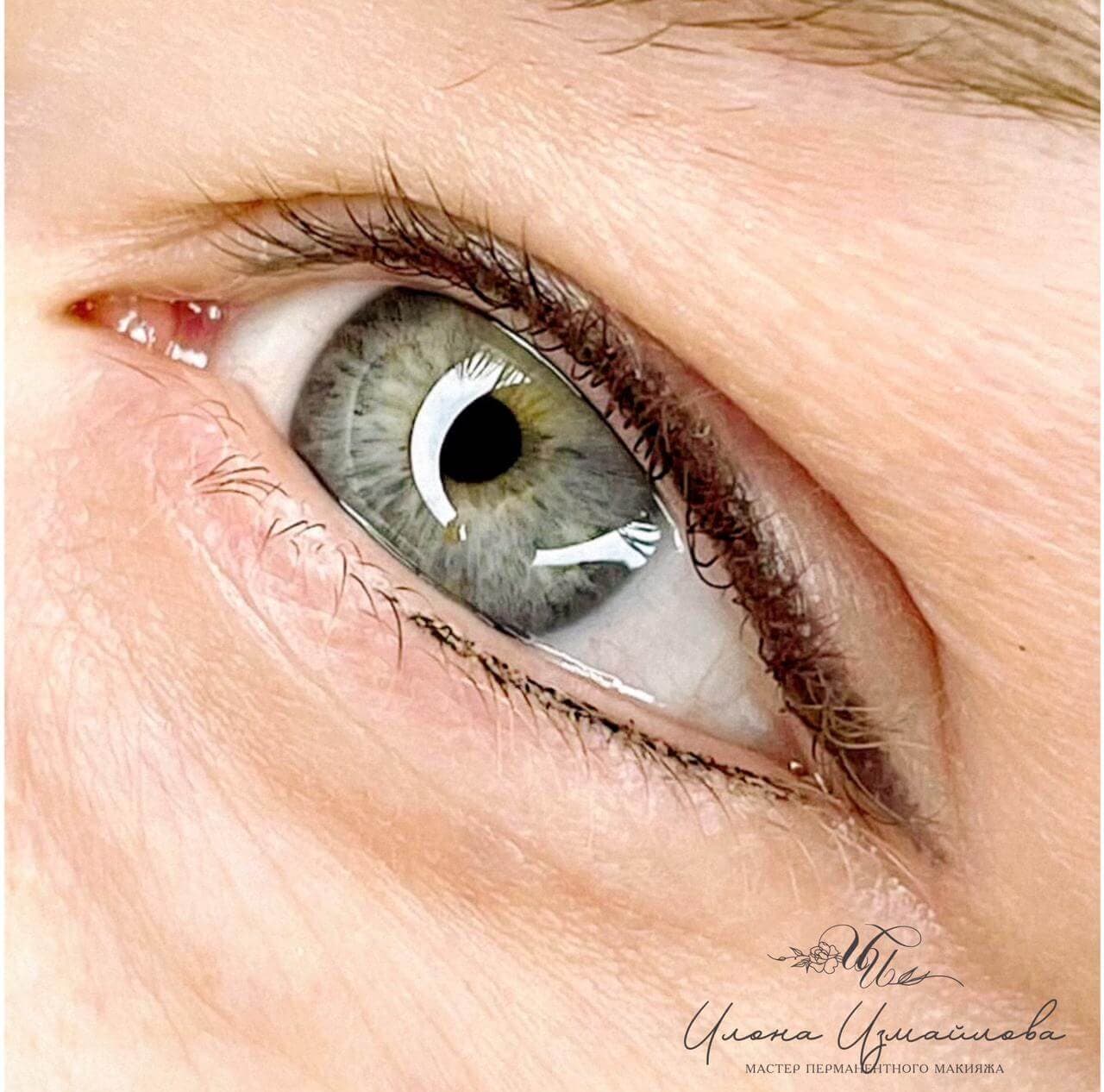 Нижнее веко